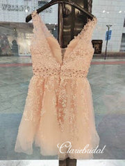 Feedback for V-neck Lace Beaded Dresses